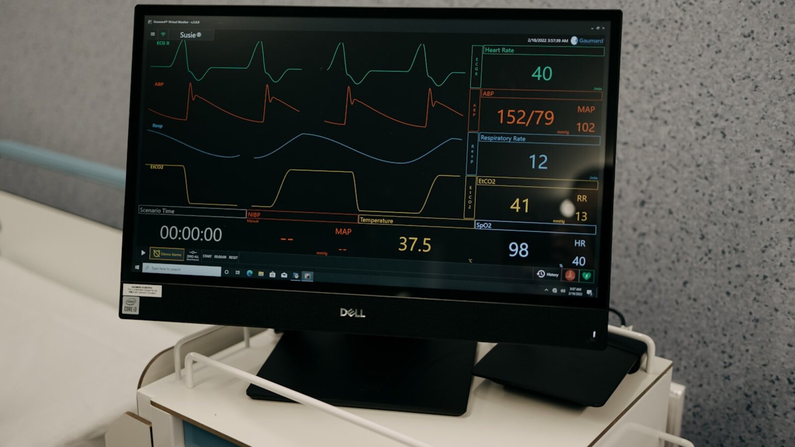 How to Build a Camera-Based AI Sleep Detection App